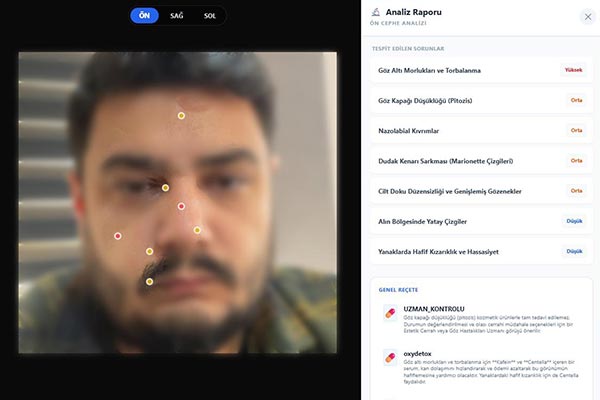 Yapay Zeka Destekli Cilt Analiz Projesi